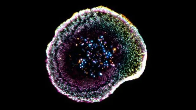 L'imagerie 3D révèle le mécanisme de destruction des cellules T