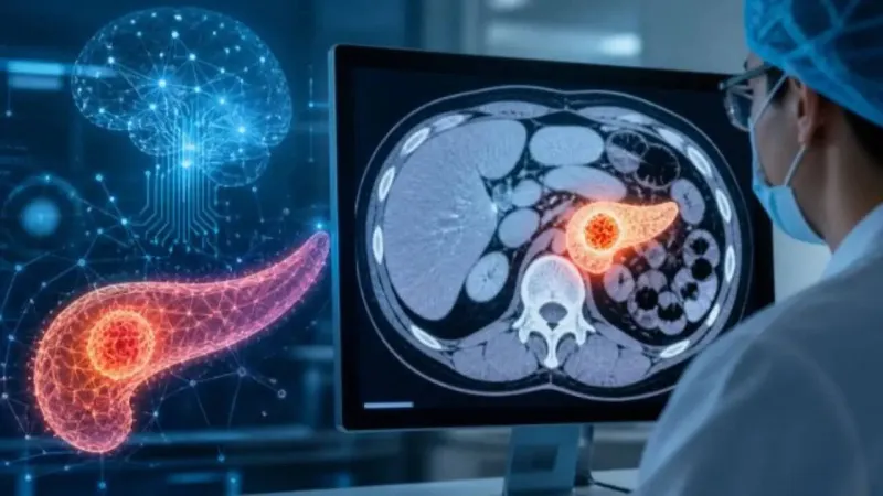 L'IA détecte le cancer du pancréas 3 ans plus tôt