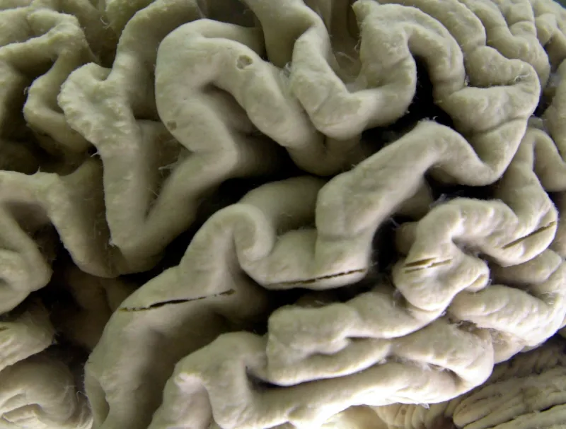 Blood test may predict Alzheimer's risk in healthy adults