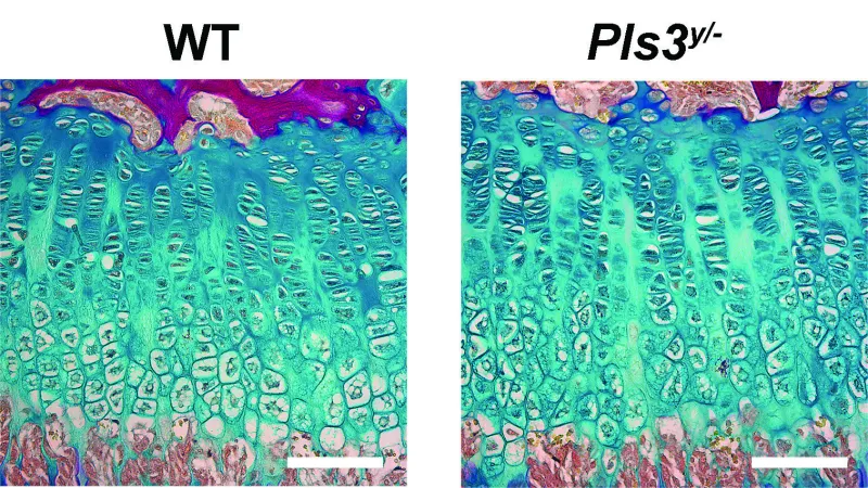 Les cellules des vaisseaux sanguins clés dans la guérison osseuse