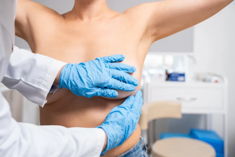 Les lacunes du dépistage BRCA persistent malgré les directives