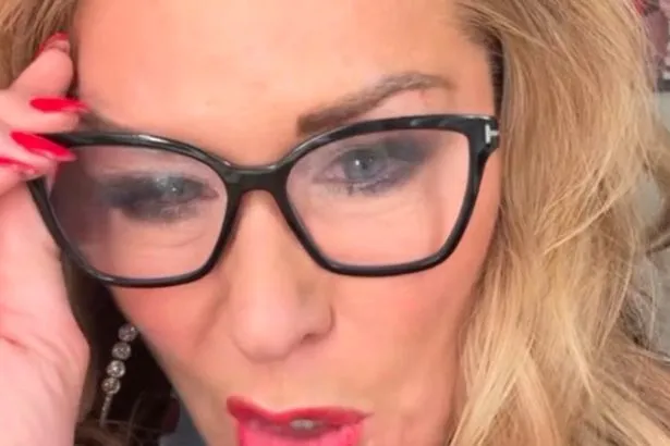 Claire Sweeney blessée au visage après une chute