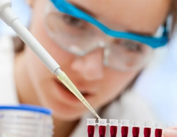L'FDA approuve un test sanguin pour diagnostiquer Alzheimer