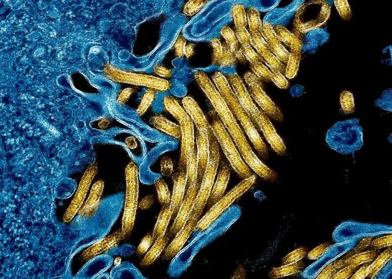 Cas d'Ebola confirmé chez un médecin revenant du Congo