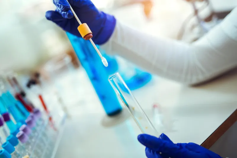 Le GCLA encourage l'utilisation de services de laboratoire accrédités en Tanzanie