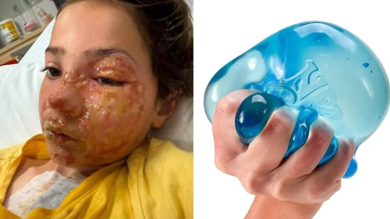 Fillette brûlée par un jouet passé au micro-ondes, son père victime de cyberharcèlement