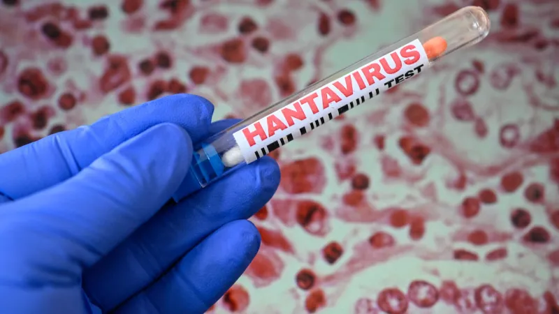 Épidémie de hantavirus fait grimper les actions pharmaceutiques