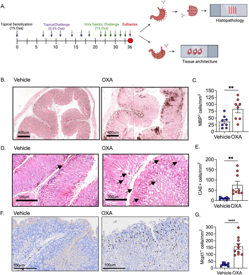 Mécanismes immunitaires identifiés dans une maladie rare de l'estomac