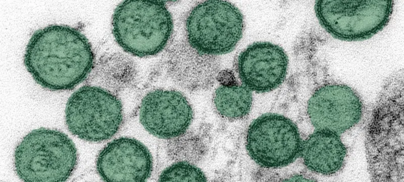 Le Kenya renforce le contrôle après un cas de Hantavirus