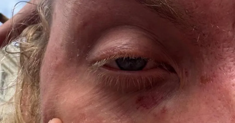 Homme blessé dans une attaque au couteau à Brighton