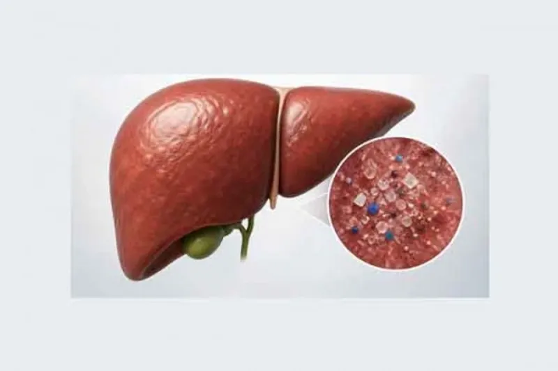 Les microplastiques liés au risque de maladie du foie