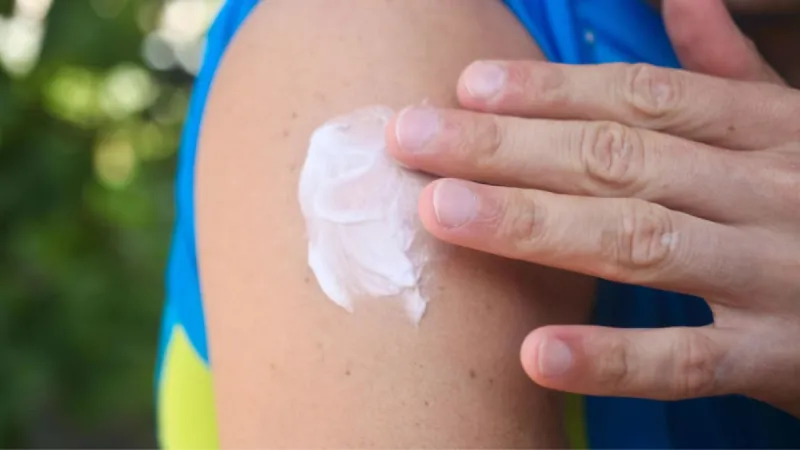 Crèmes anti-moustiques : risques cutanés vs protection contre les maladies
