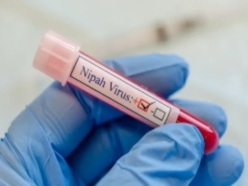 Virus Nipah confirmé chez un homme à Kozhikode