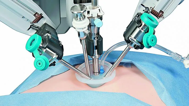 Chirurgie robotique faible complication dans l'endométriose