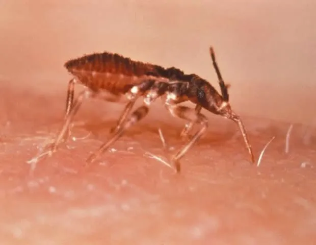 Les modifications des ARNt pilotent la transformation du parasite de Chagas