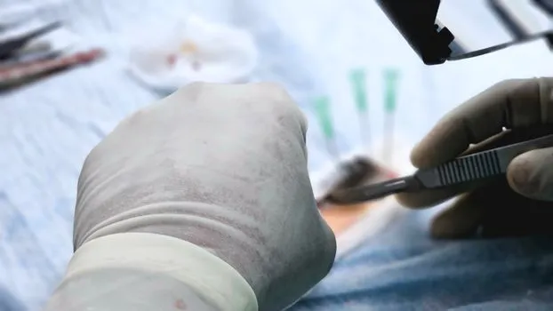 Première greffe de pénis au Vietnam avec un donneur en état de mort cérébrale